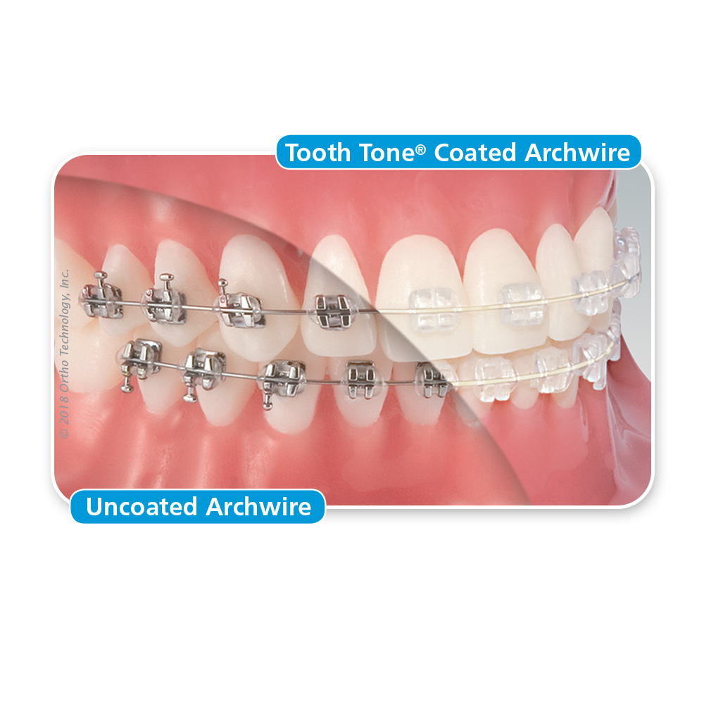 Tooth Tone®Coated Niti & SS (Full Form Archwires) ValueRx, Inc.