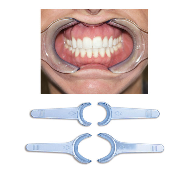 thumbnail interactive-video image 1 of Orringer Photographic Lip Cheek Retractor - Large Size - Dental Photography Tool By TM 1 of 5